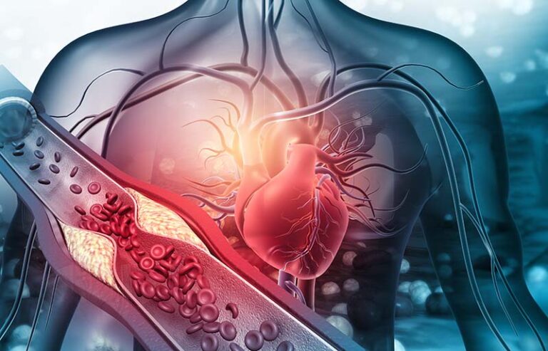 elettrocardiogramma-nefrocenter-cardio-news